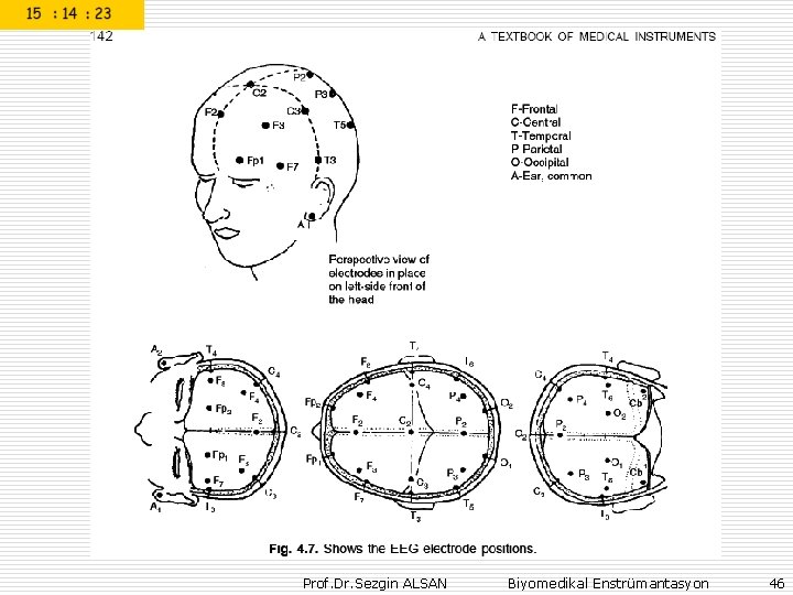 Prof. Dr. Sezgin ALSAN Biyomedikal Enstrümantasyon 46 