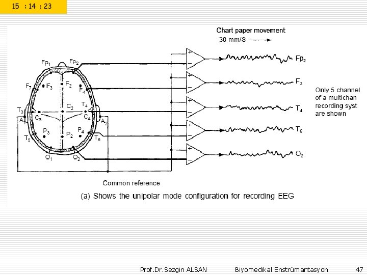 Prof. Dr. Sezgin ALSAN Biyomedikal Enstrümantasyon 47 