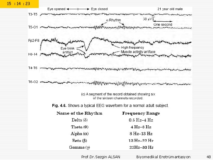 Prof. Dr. Sezgin ALSAN Biyomedikal Enstrümantasyon 48 