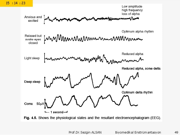 Prof. Dr. Sezgin ALSAN Biyomedikal Enstrümantasyon 49 