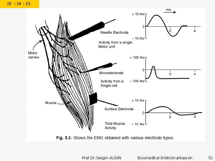 Prof. Dr. Sezgin ALSAN Biyomedikal Enstrümantasyon 51 