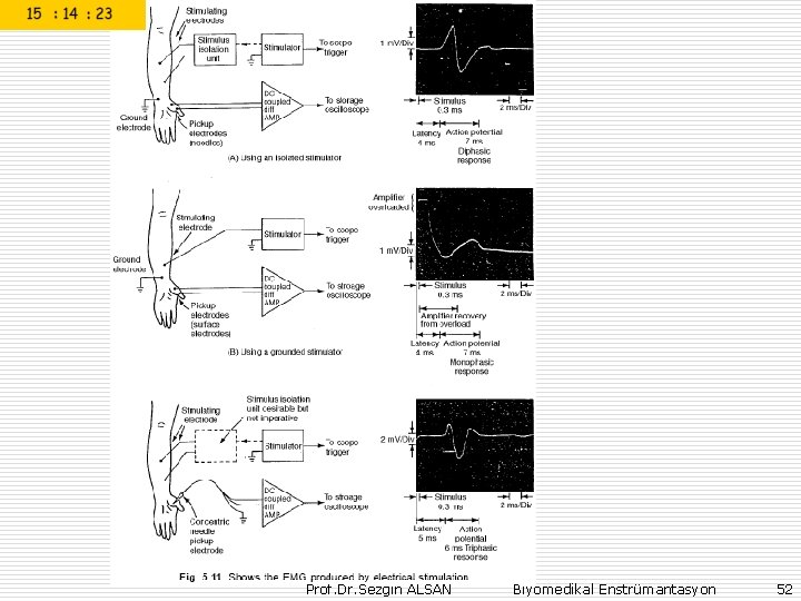 Prof. Dr. Sezgin ALSAN Biyomedikal Enstrümantasyon 52 