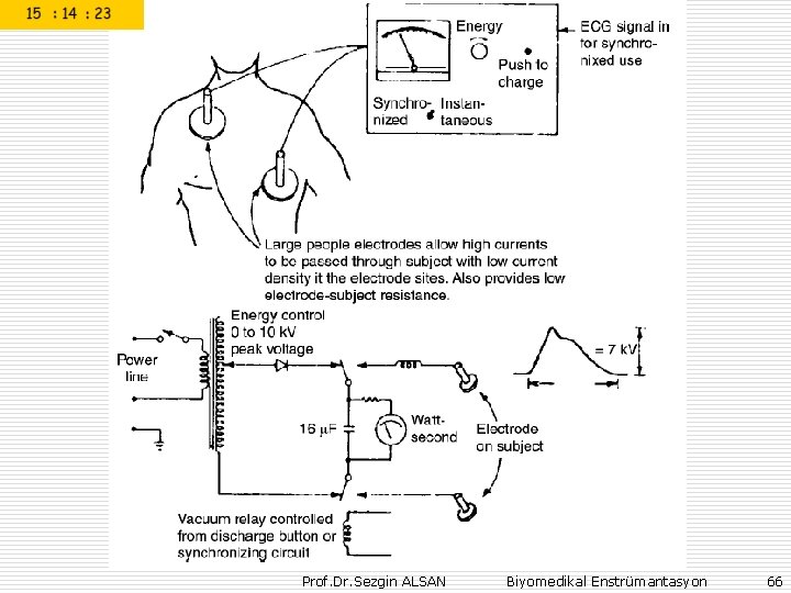 Prof. Dr. Sezgin ALSAN Biyomedikal Enstrümantasyon 66 