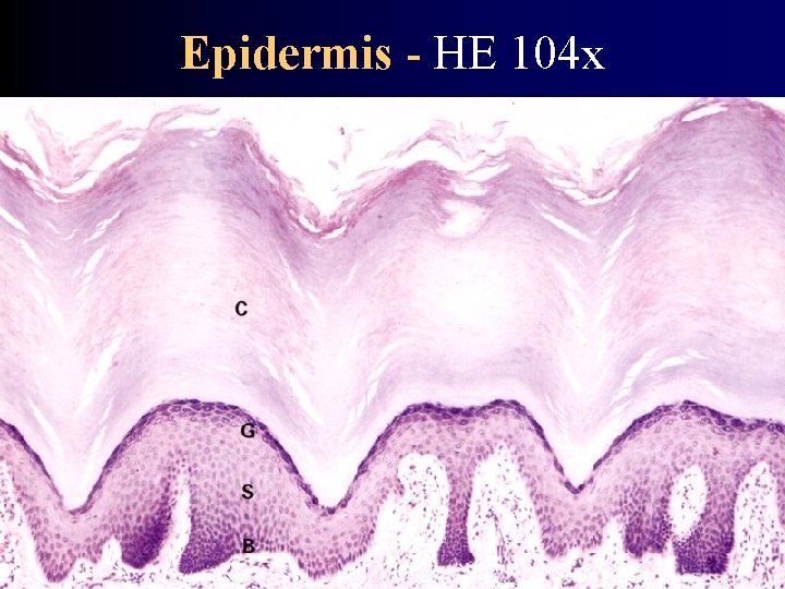 Epidermis - HE 104 x 