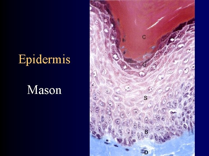 Epidermis Mason 