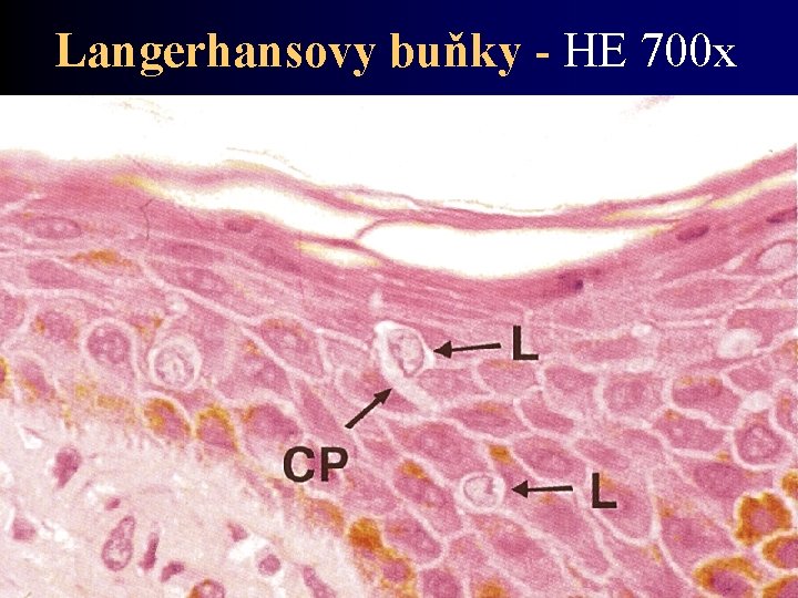 Langerhansovy buňky - HE 700 x 