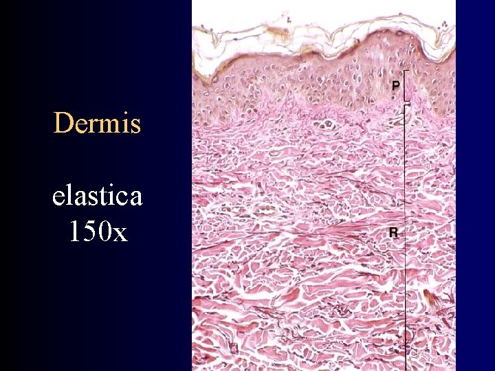 Dermis elastica 150 x 