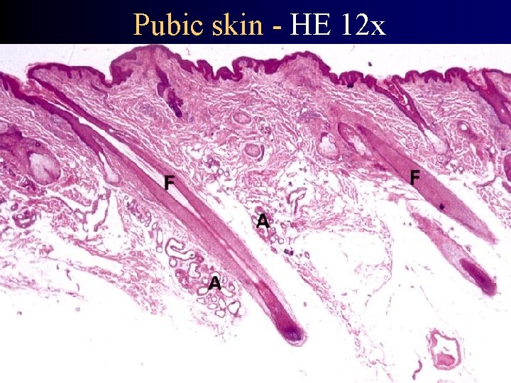 Pubic skin - HE 12 x 