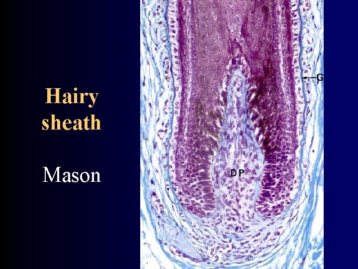 Hairy sheath Mason 