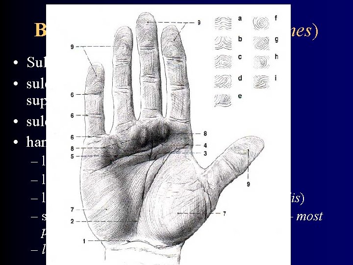 Bending sulci (lineae distractiones) • Sulci at joints, wrinkles • sulcus mentolabialis, nasolabialis, suprapalpebralis,