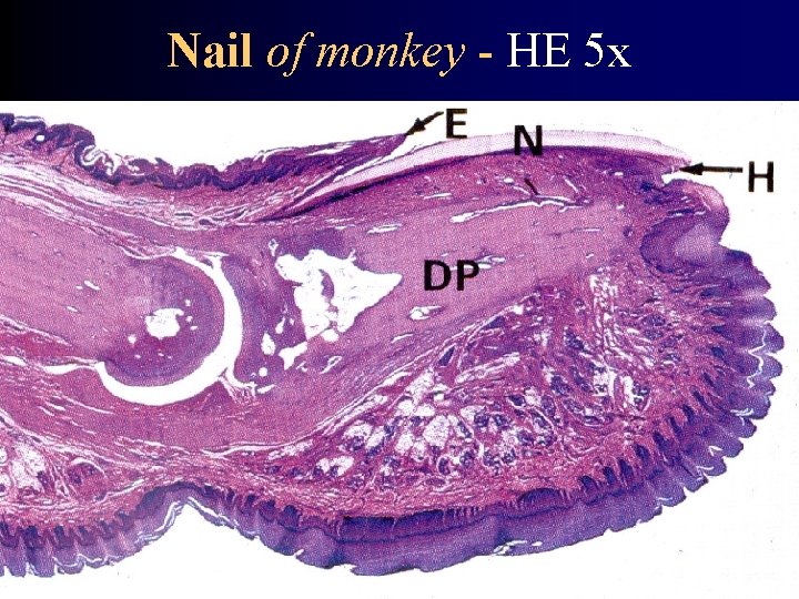 Nail of monkey - HE 5 x 