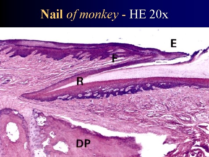 Nail of monkey - HE 20 x 