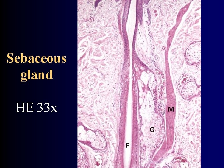 Sebaceous gland HE 33 x 