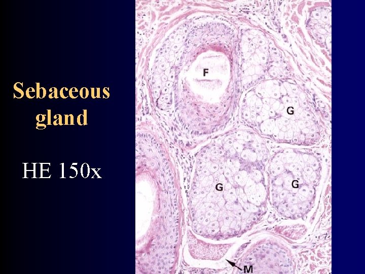 Sebaceous gland HE 150 x 