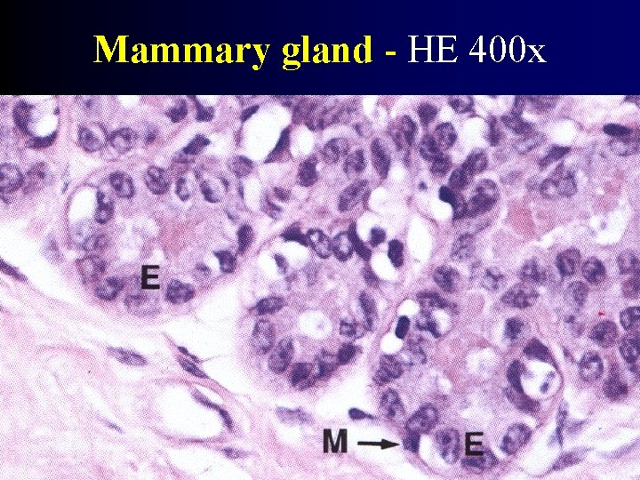 Mammary gland - HE 400 x 
