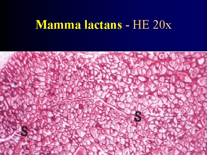 Mamma lactans - HE 20 x 