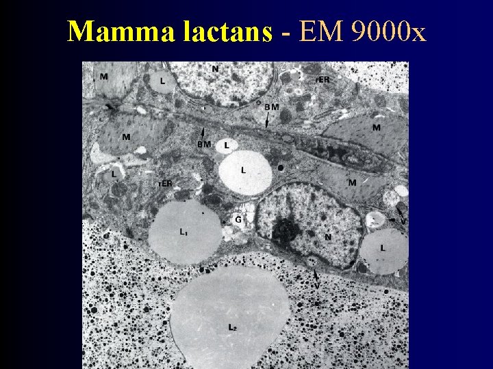 Mamma lactans - EM 9000 x 