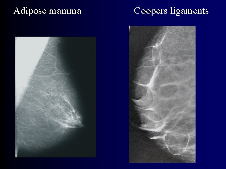 Adipose mamma Coopers ligaments 