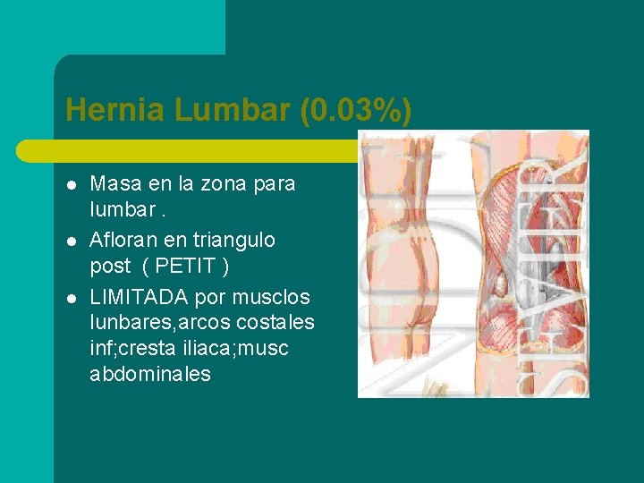 Hernia Lumbar (0. 03%) l l l Masa en la zona para lumbar. Afloran