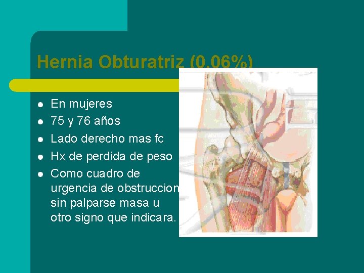 Hernia Obturatriz (0. 06%) l l l En mujeres 75 y 76 años Lado