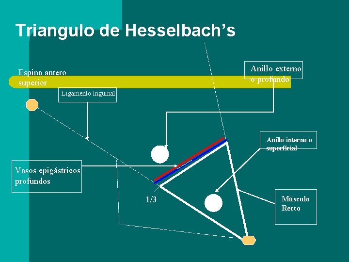 Triangulo de Hesselbach’s Anillo externo o profundo Espina antero superior Ligamento Inguinal Anillo interno