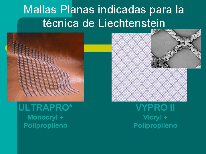 Mallas Planas indicadas para la técnica de Liechtenstein ULTRAPRO* VYPRO II Monocryl + Polipropileno