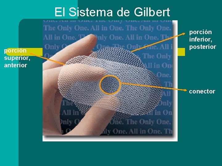 El Sistema de Gilbert porción superior, anterior porción inferior, posterior conector 