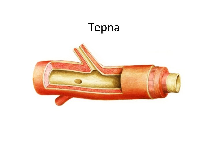 Tepna 