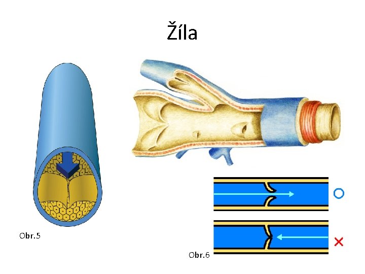 Žíla Obr. 5 Obr. 6 