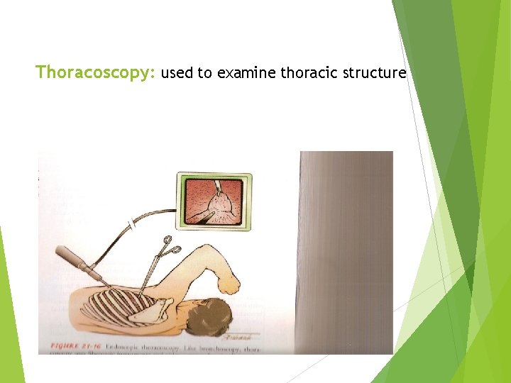 Thoracoscopy: used to examine thoracic structure 