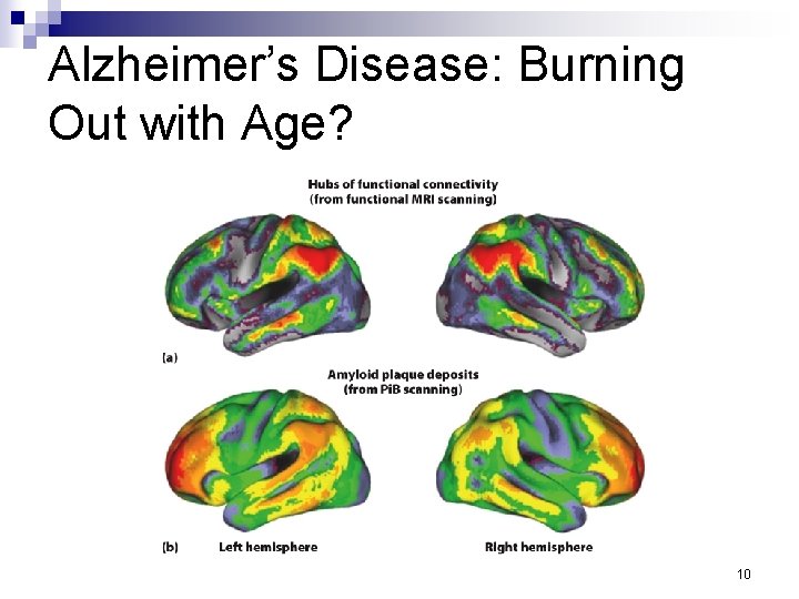 Alzheimer’s Disease: Burning Out with Age? 10 