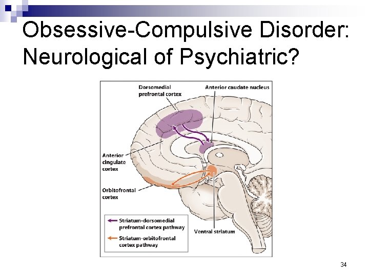 Obsessive-Compulsive Disorder: Neurological of Psychiatric? 34 