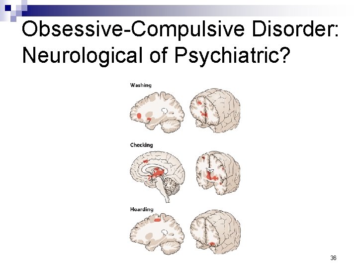 Obsessive-Compulsive Disorder: Neurological of Psychiatric? 36 