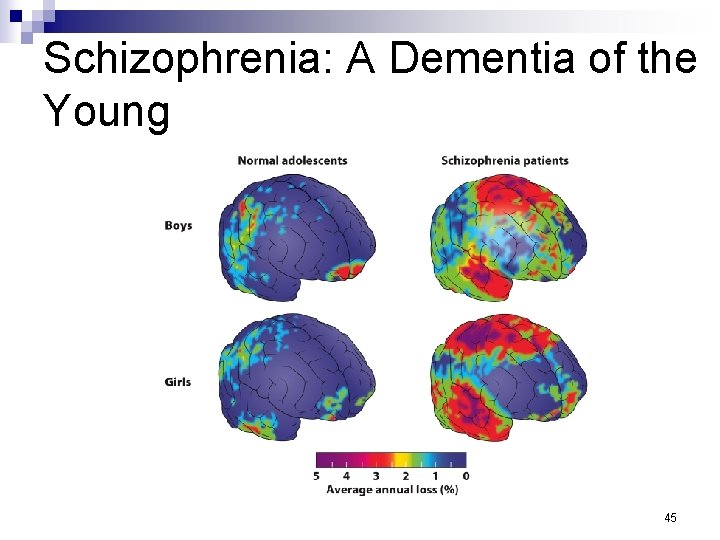 Schizophrenia: A Dementia of the Young 45 