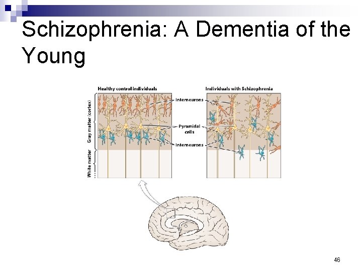 Schizophrenia: A Dementia of the Young 46 