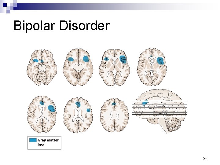 Bipolar Disorder 54 