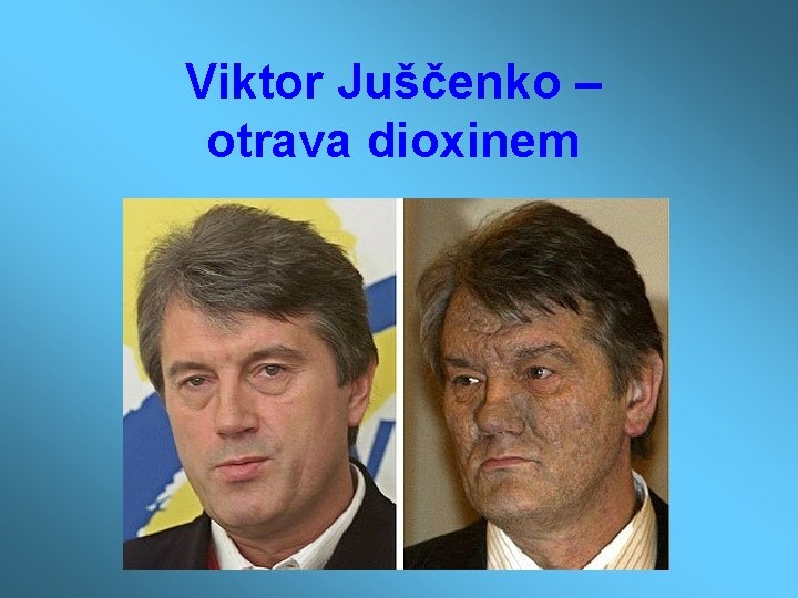 Viktor Juščenko – otrava dioxinem 