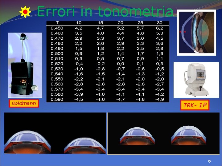 Errori in tonometria Goldmann TRK- 1 P 15 Errori in tonometria Goldmann TRK- 1 P 15