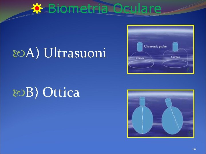 Biometria Oculare A) Ultrasuoni B) Ottica 26 Biometria Oculare A) Ultrasuoni B) Ottica 26