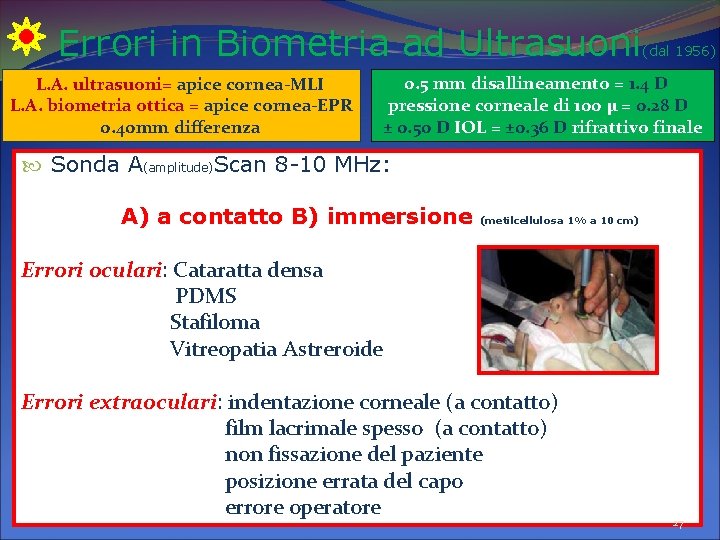 Errori in Biometria ad Ultrasuoni (dal 1956) L. A. ultrasuoni= apice cornea-MLI L. A. Errori in Biometria ad Ultrasuoni (dal 1956) L. A. ultrasuoni= apice cornea-MLI L. A.