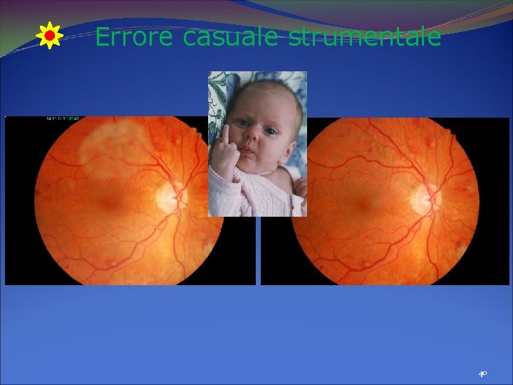 Errore casuale strumentale 40 Errore casuale strumentale 40
