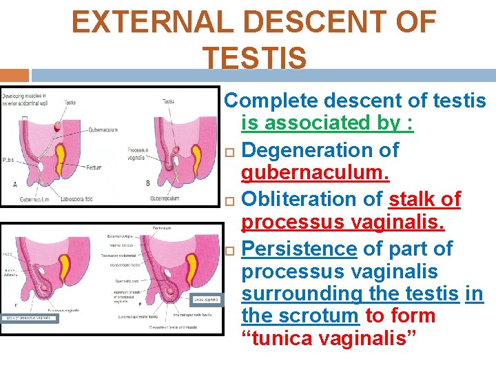 EXTERNAL DESCENT OF TESTIS Complete descent of testis is associated by : Degeneration of