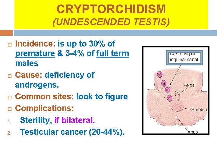 CRYPTORCHIDISM (UNDESCENDED TESTIS) 1. 2. Incidence: is up to 30% of premature & 3