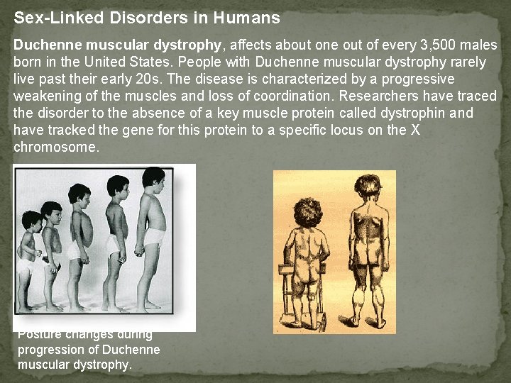 Sex-Linked Disorders in Humans Duchenne muscular dystrophy, affects about one out of every 3,