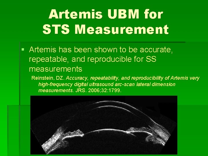 Artemis UBM for STS Measurement § Artemis has been shown to be accurate, repeatable, Artemis UBM for STS Measurement § Artemis has been shown to be accurate, repeatable,