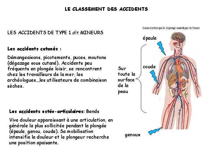 LE CLASSEMENT DES ACCIDENTS LES ACCIDENTS DE TYPE 1 dit MINEURS épaule Les accidents