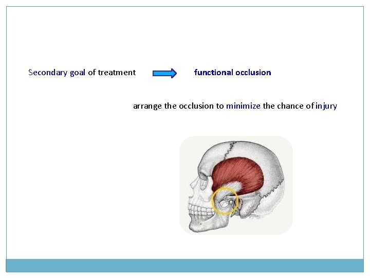 Secondary goal of treatment functional occlusion arrange the occlusion to minimize the chance of Secondary goal of treatment functional occlusion arrange the occlusion to minimize the chance of
