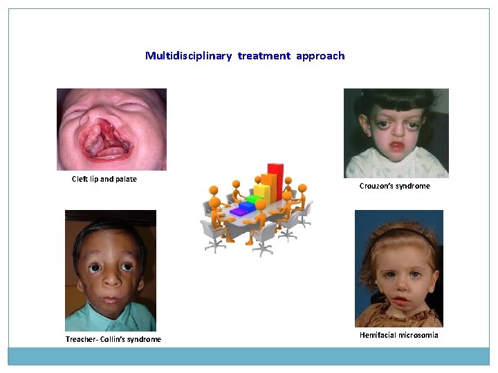 Multidisciplinary treatment approach Cleft lip and palate Treacher- Collin’s syndrome Crouzon’s syndrome Hemifacial microsomia Multidisciplinary treatment approach Cleft lip and palate Treacher- Collin’s syndrome Crouzon’s syndrome Hemifacial microsomia