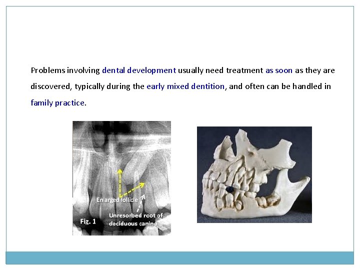 Problems involving dental development usually need treatment as soon as they are discovered, typically Problems involving dental development usually need treatment as soon as they are discovered, typically