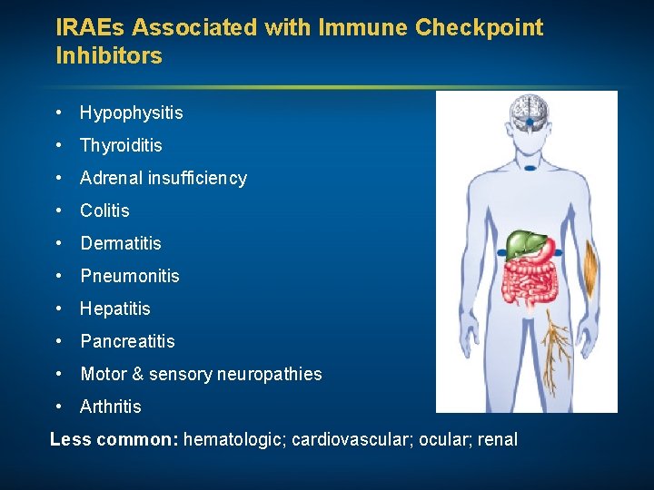 IRAEs Associated with Immune Checkpoint Inhibitors • Hypophysitis • Thyroiditis • Adrenal insufficiency •